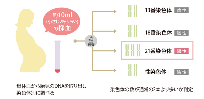 約10ml（小さじ2杯くらい）の採血を行い、母体血から胎児のDNAを取り出し染色体別に調べます。染色体の数が通常の2本より多いかどうか、判定を行います。